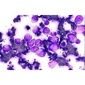 Colorante Diff Stain Quick